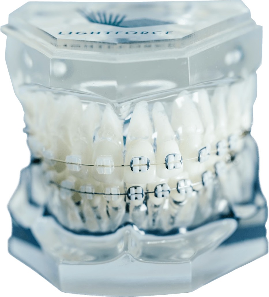 invisalign orlando
