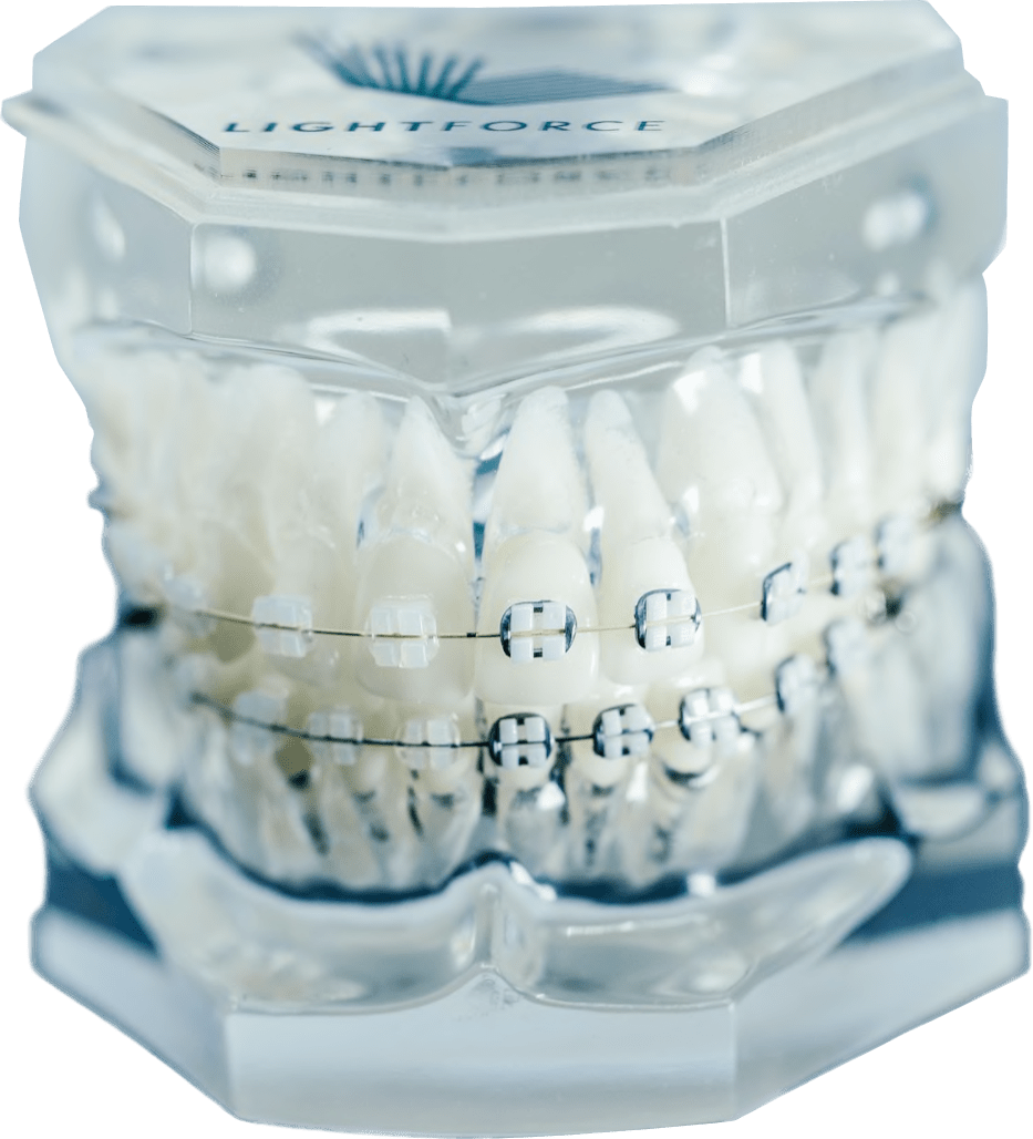 invisalign orlando