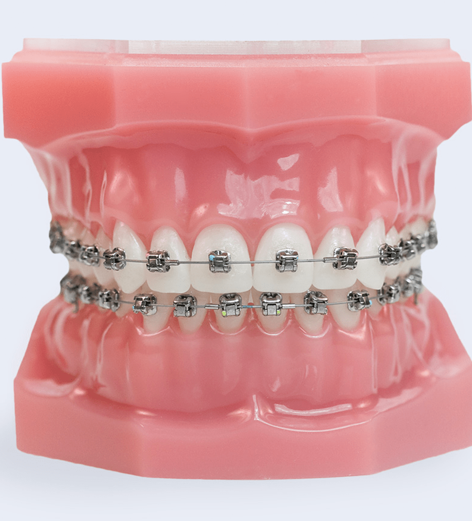 invisalign orlando