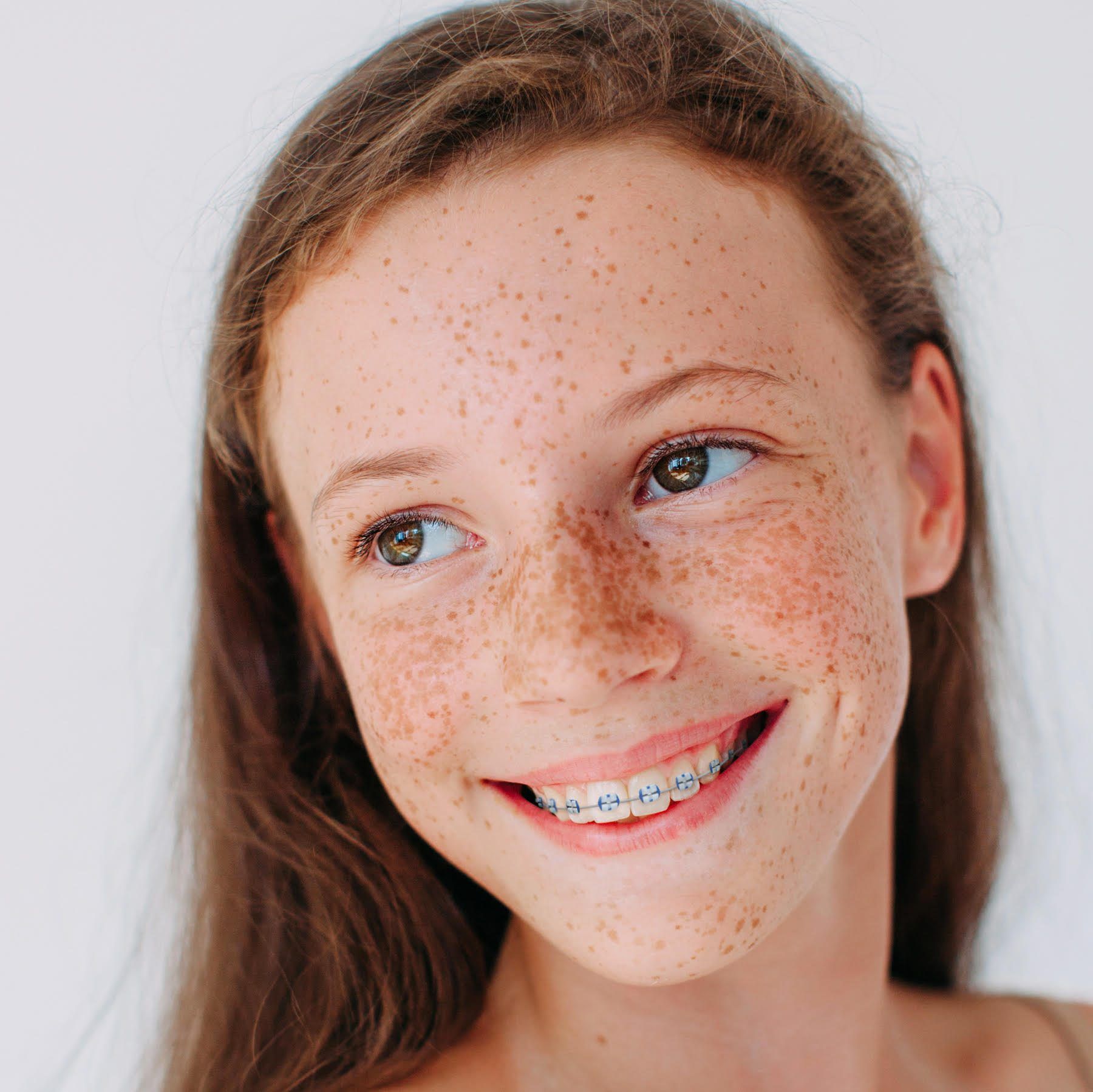 invisalign orlando
