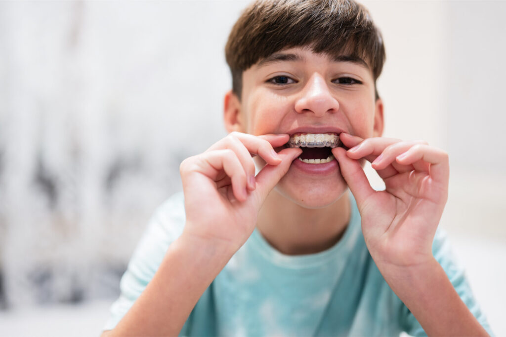 Smiling teen boy putting a clear aligner over his teeth during Invisalign treatment for a straighter smile with Orlando orthodontics at Marris Orthodontics